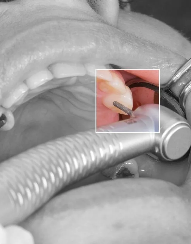 Oral rehabilitation treatment at Be Dharma Dental in Medellín