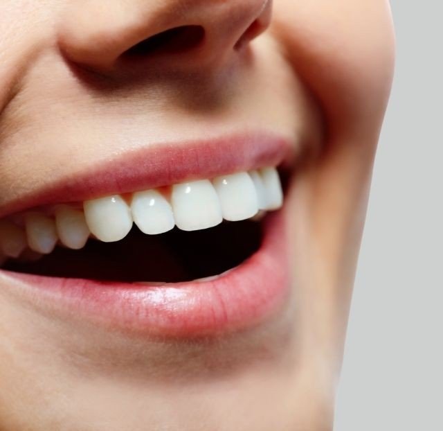 Resina de Alta Estética en Medellín - Diseño de Sonrisa en Medellín - Be Dharma Dental