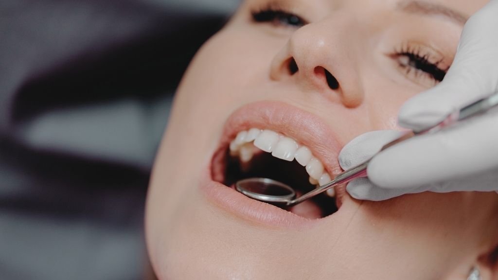 Cuidados después de un blanqueamiento dental para mantener una sonrisa blanca - Be Dharma Dental 2