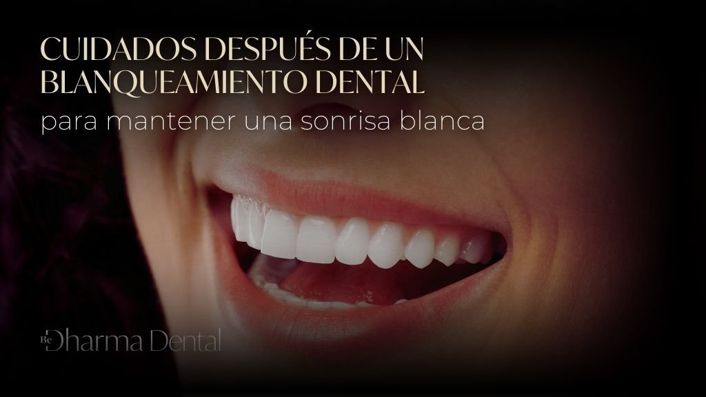 Cuidados después de un blanqueamiento dental para mantener una sonrisa blanca - Be Dharma Dental