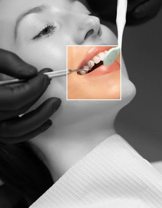 Professional dental cleaning at Be Dharma Dental in Medellín