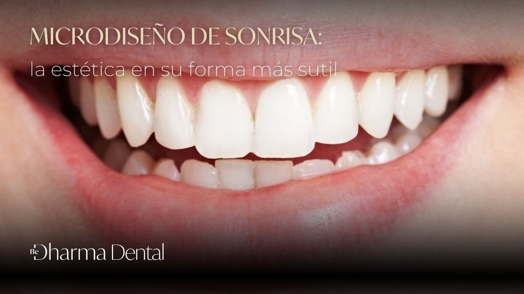 Microdiseño de sonrisa - BE DHARMA DENTAL Medellín