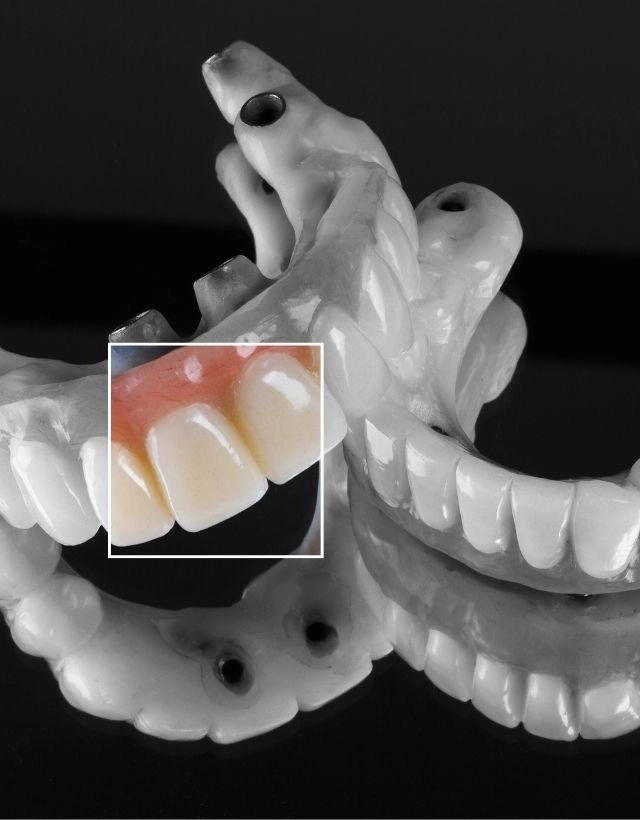 Be dharma dental - Prótesis dentales