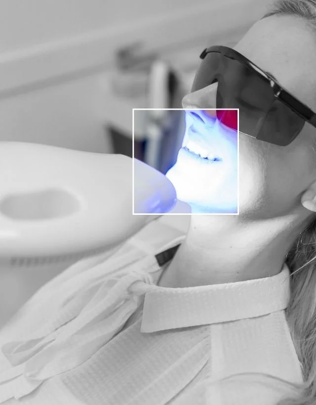 Blanqueamiento-dental-con-Laser-en-Medellin-Centro-Estetico-Be-Dharma-en-Medellin-Be-Dharma-Dental-Colombia-Odontologia-Estetica-en-Medellin