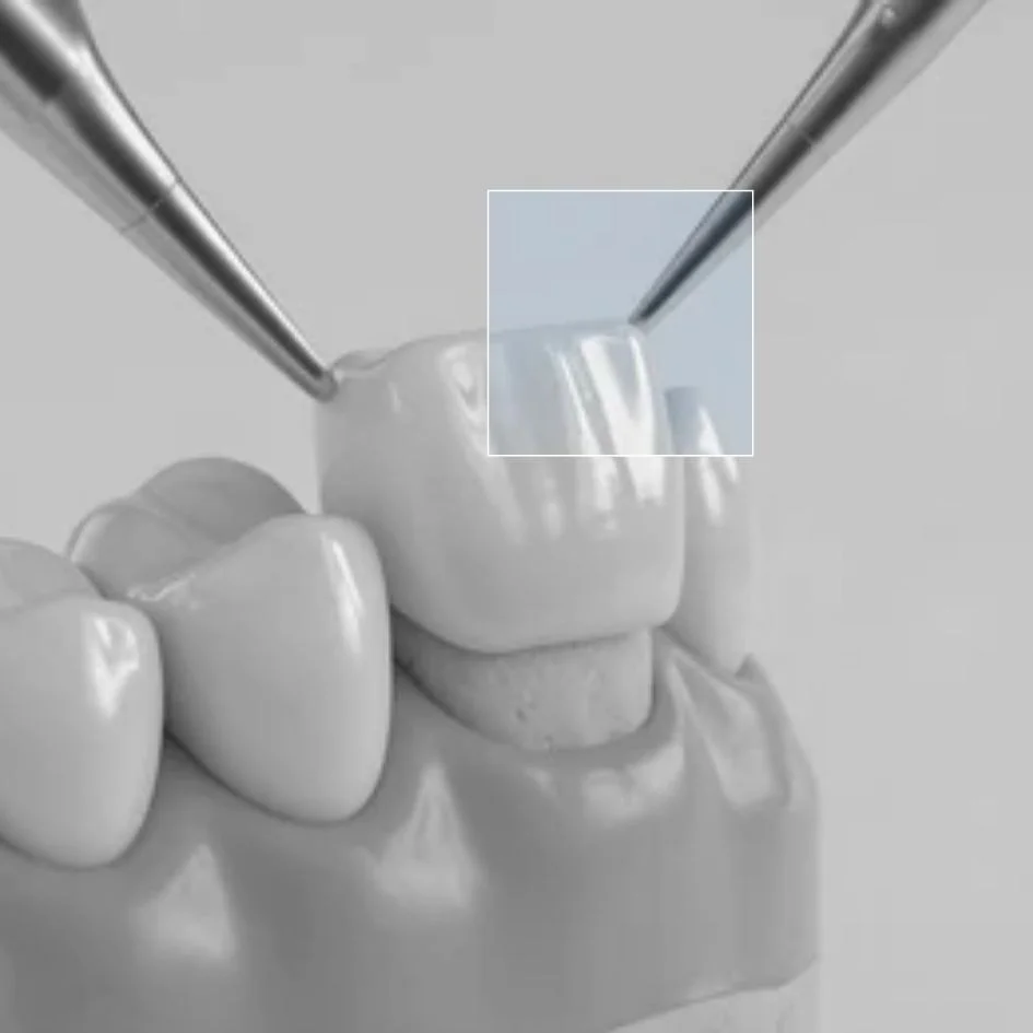 Coronas-dentales-en-Medellin-Odontologia-Estetica-en-Medellin-Be-Dharma-Dental