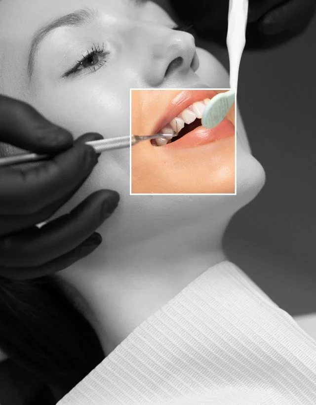 Higiene-Oral-en-Medellin-Centro-Estetico-Be-Dharma-en-Medellin-Be-Dharma-Dental