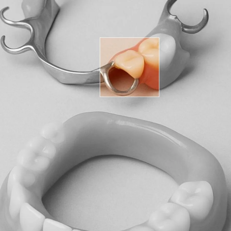 Placas-dentales-esteticas-en-Medellin-Odontologia-estetica-en-Medellin-Be-Dharma-Dental