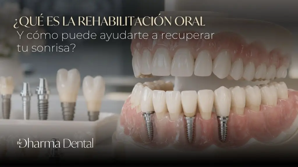 Rehabilitación oral - Be Dharma Dental