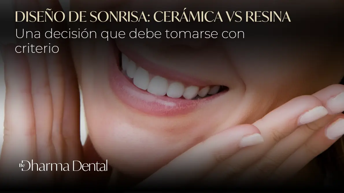 Diseño de sonrisa en cerámica vs resina- Dharma Dental- Torre Médica de Oviedo