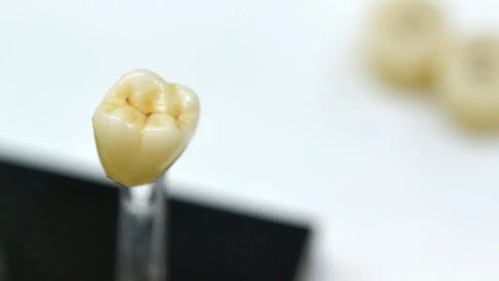 Precio corona dental e implante dental en Medellín - Clínica de odontología estética Be Dharma Dental