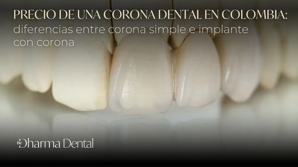 Valor de una corona dental en colombia - Clínica odontológica Be Dharma Dental