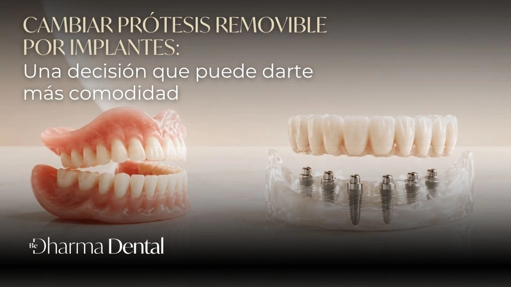 Cambiar prótesis removible por implantes Una decisión que puede darte más comodidad - Be Dharma Dental - Medellín