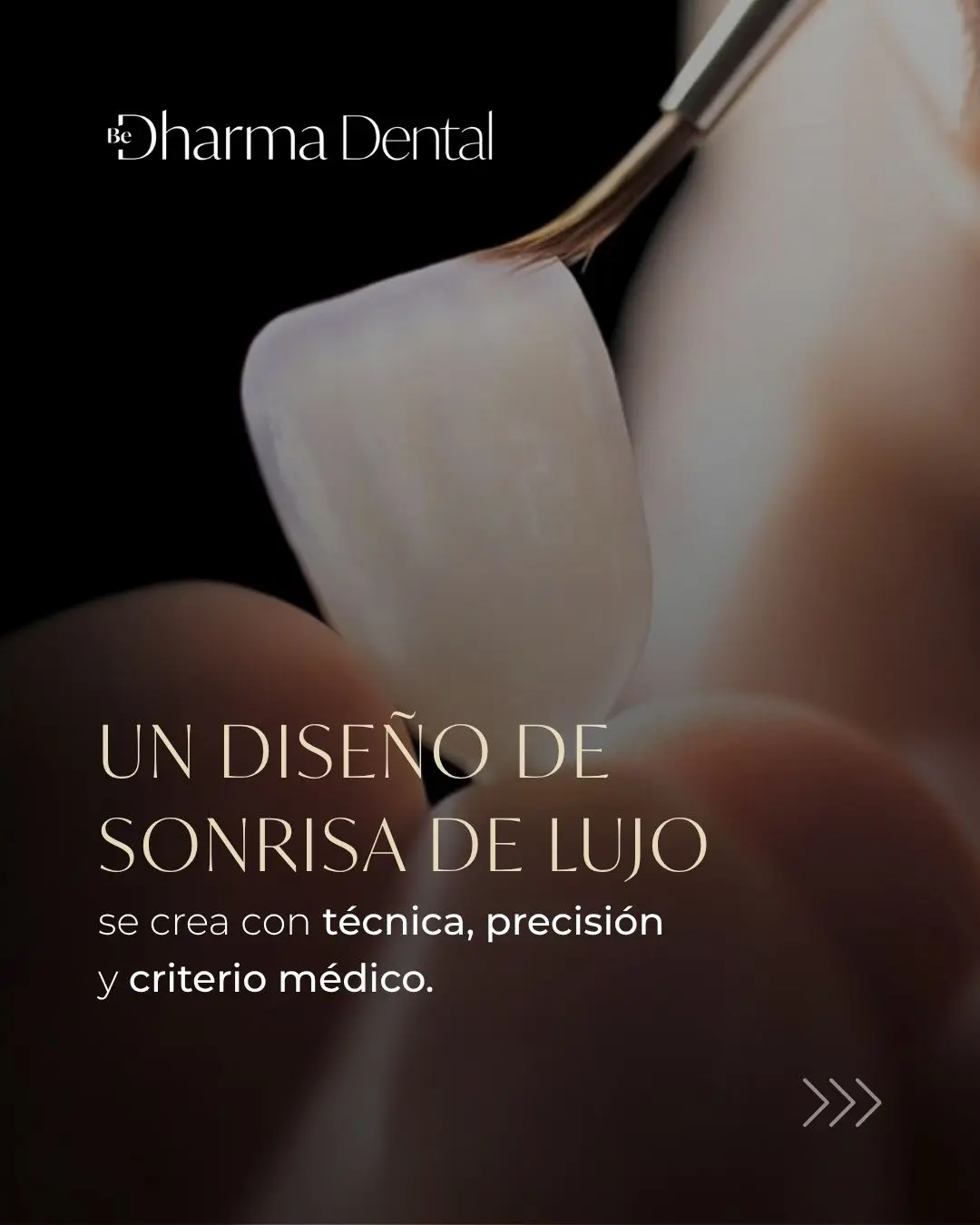 Cuánto tiempo dura un diseño de sonrisa - Clínica de odontología estética en Medellín, Colombia