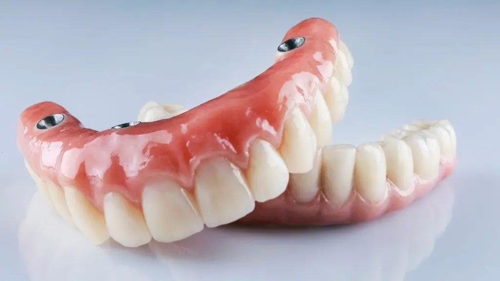 Prótesis híbridas dentales vs prótesis removibles - Clínica de odontología estética de Medellín Be Dharma Dental