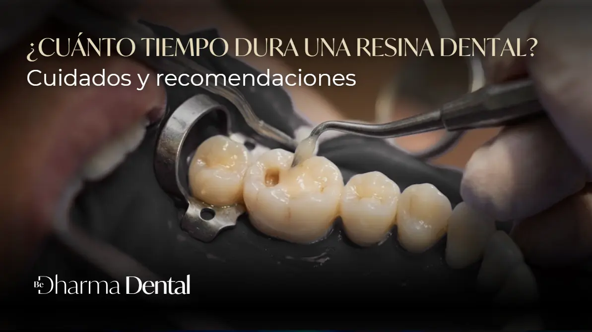 Cuánto dura una resina dental - Be Dharma Dental