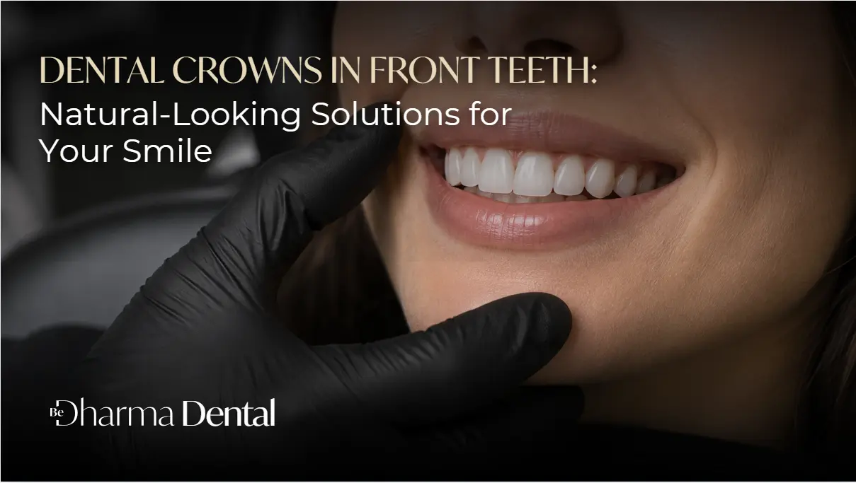 Dental Crowns in Front Teeth-Be Dharma Dental Medellín