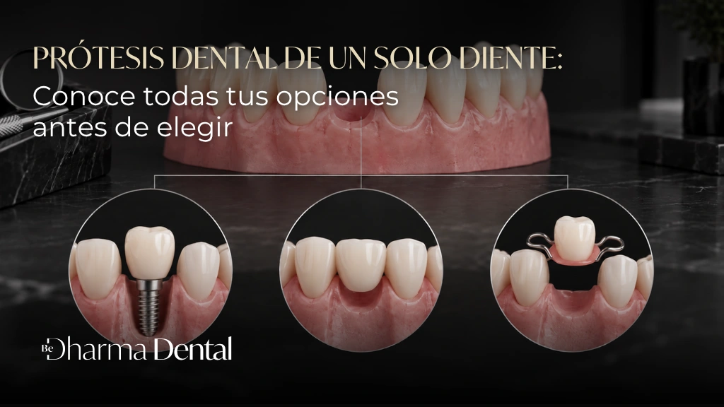 Prótesis dental de un solo diente Conoce todas tus opciones antes de elegir - Be Dharma Dental